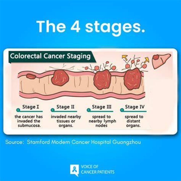 Pioneer Woman's Battle with Stage 4 Colon Cancer: A Journey of Strength and Resilience